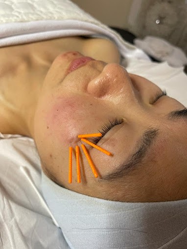 facial massage