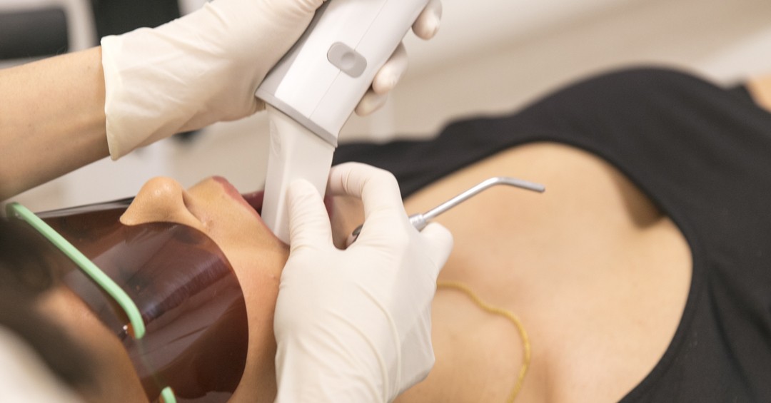 in-chair professional whitening