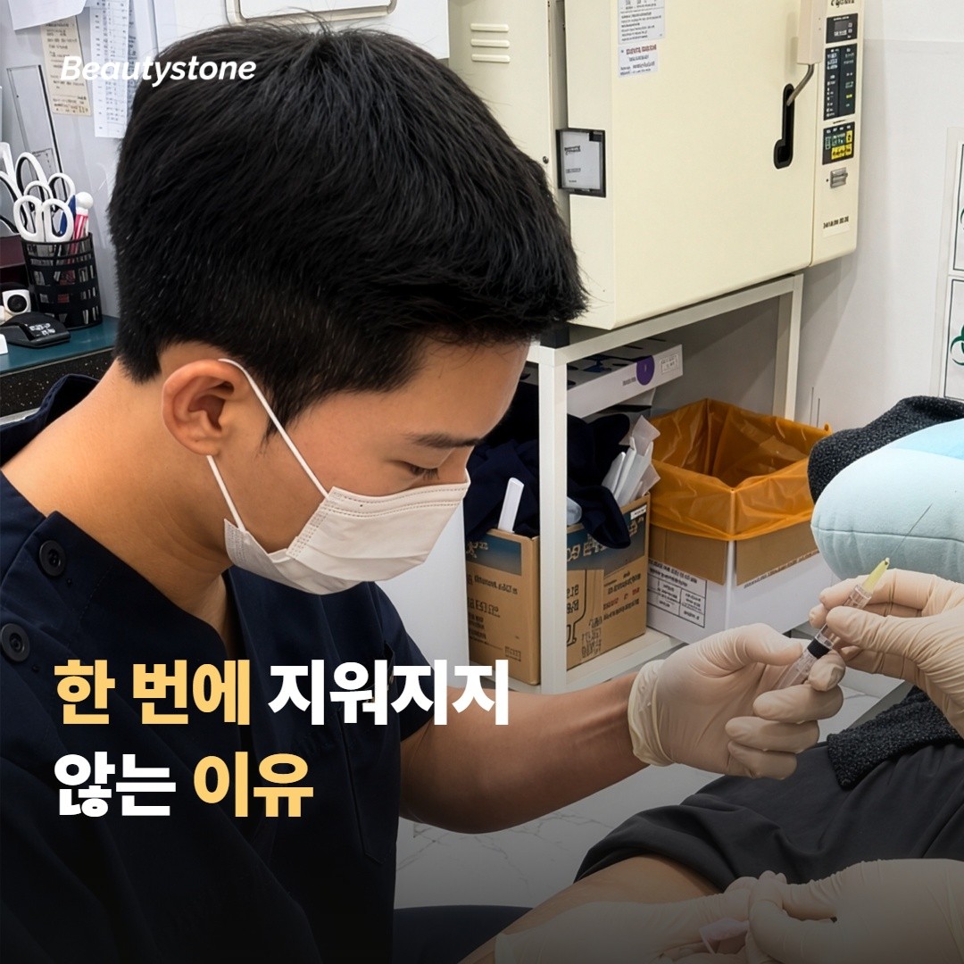 기미가 다른 색소와 달리 한 번에 지워지지 않는 이유예요