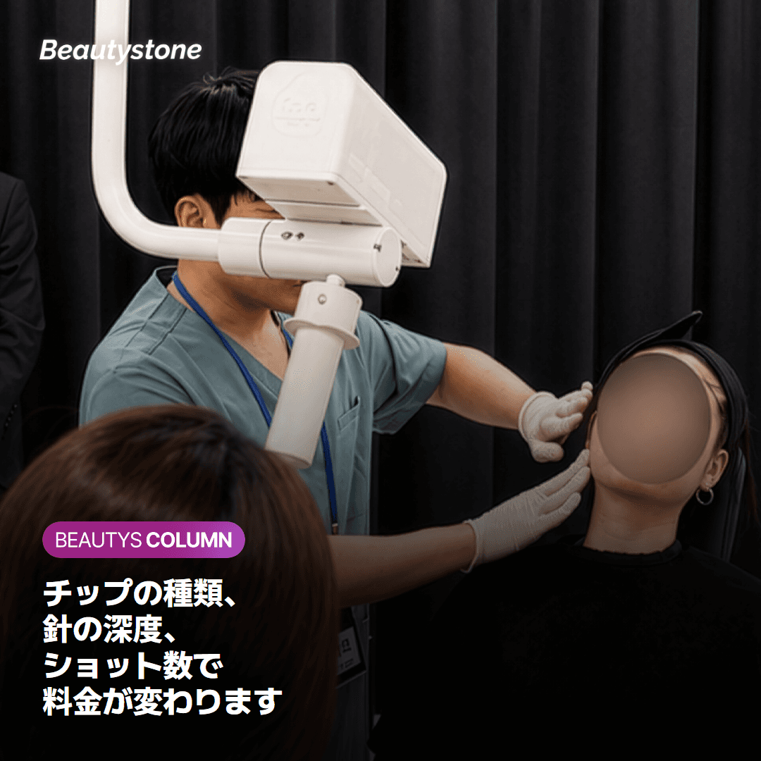 料金を左右する3つの要素 — チップ・深度・ショット数