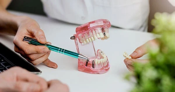 Dental Implants in Toronto | Bloor-Yorkville Periodontics