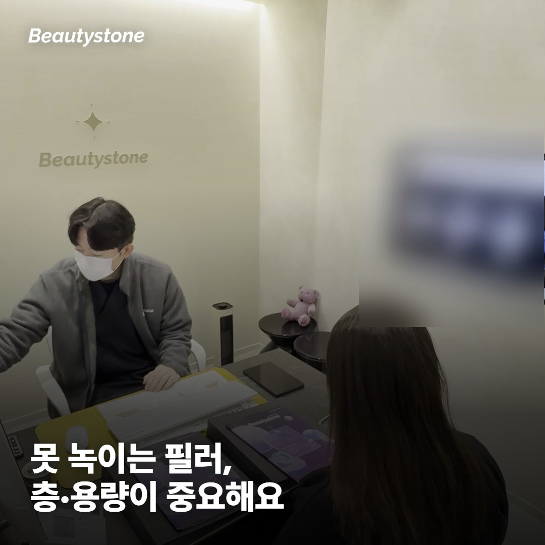 레디어스가 잘 맞는 경우, 주의할 점