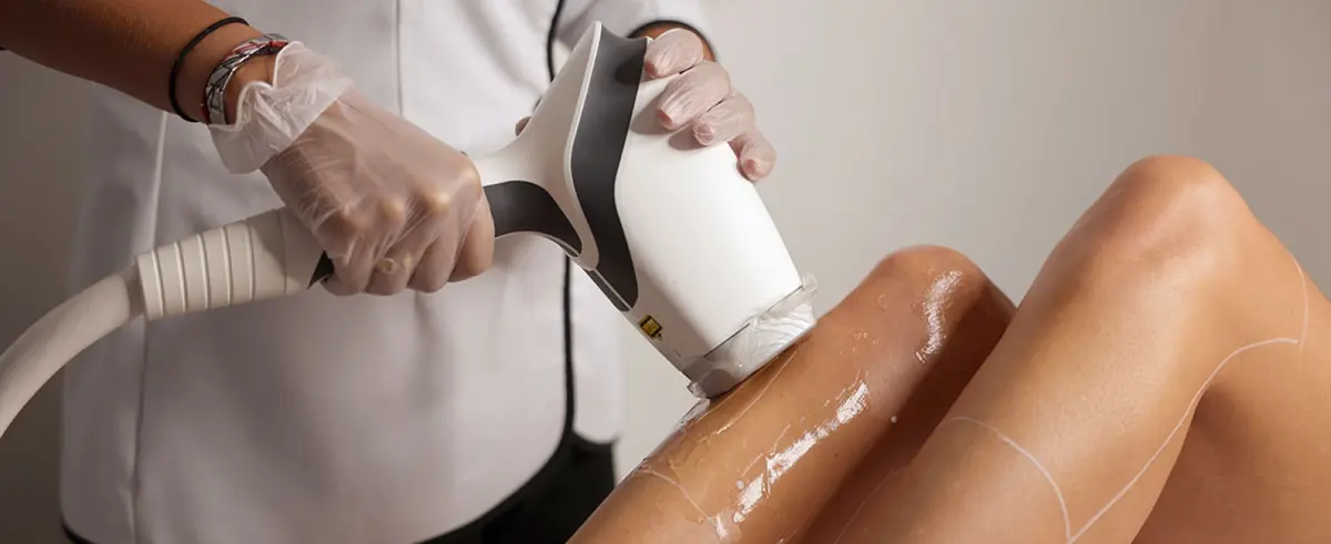 épilation des jambes