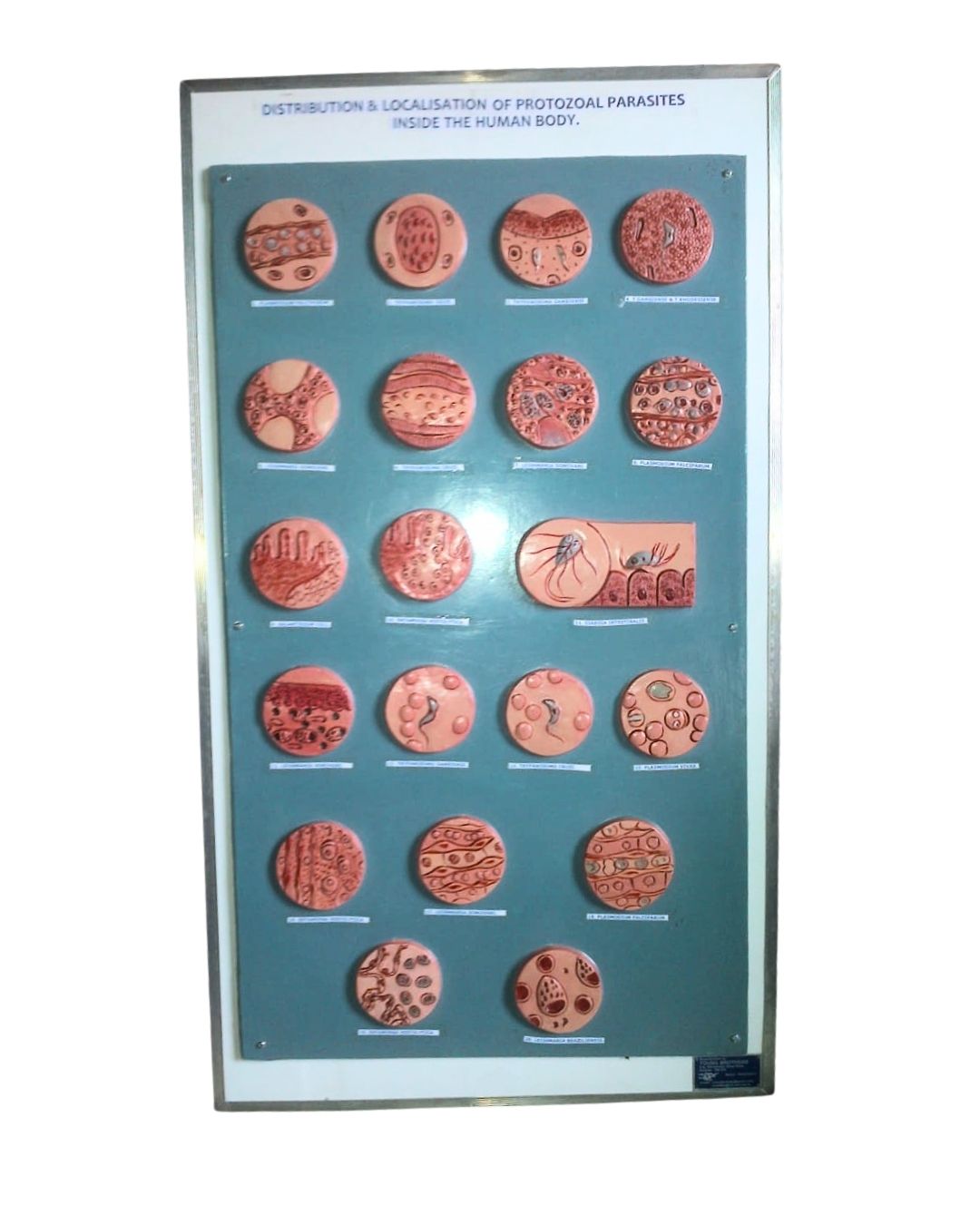 Distribution & Localisation of Protozoal Parasites inside Human Body