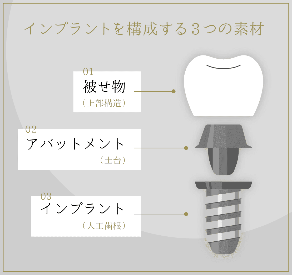 インプラントについて