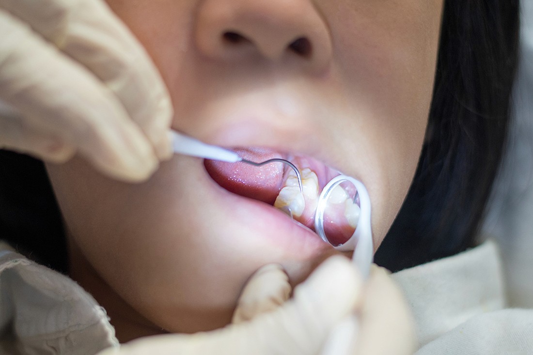 Child's dental exam with Dr. Rai, Dentist in Arlington at Shirlington Pediatric Dentistry.