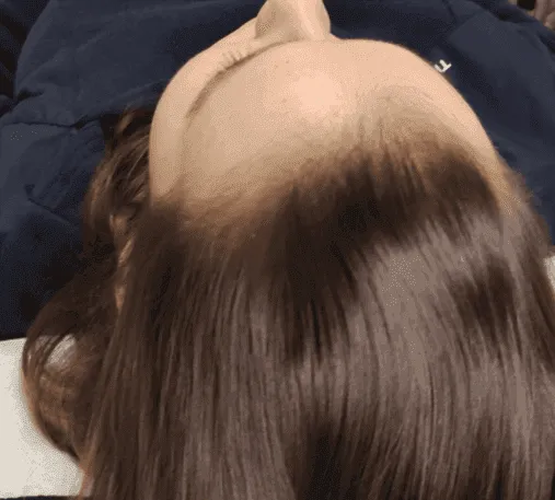 Hair After
