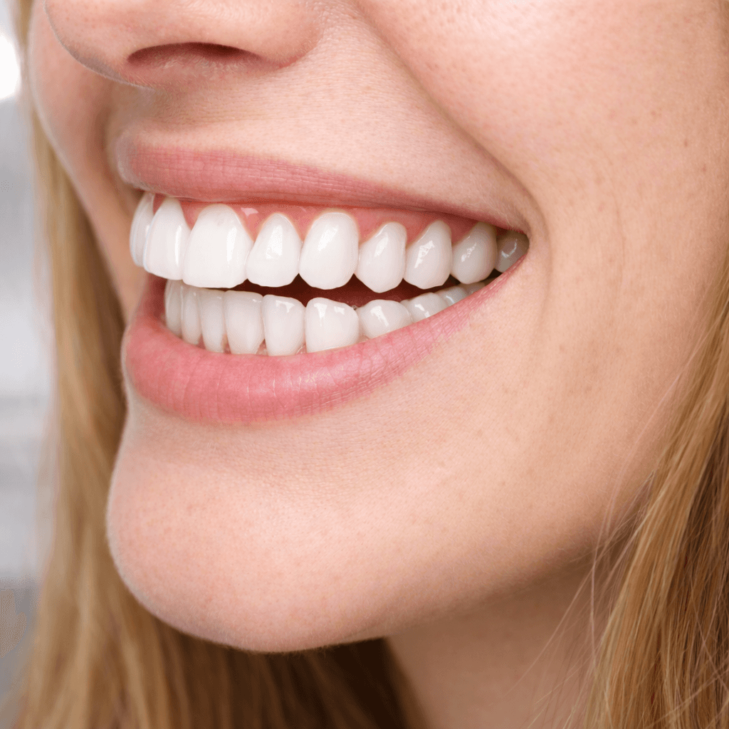 Close-up of smile with clean white teeth
