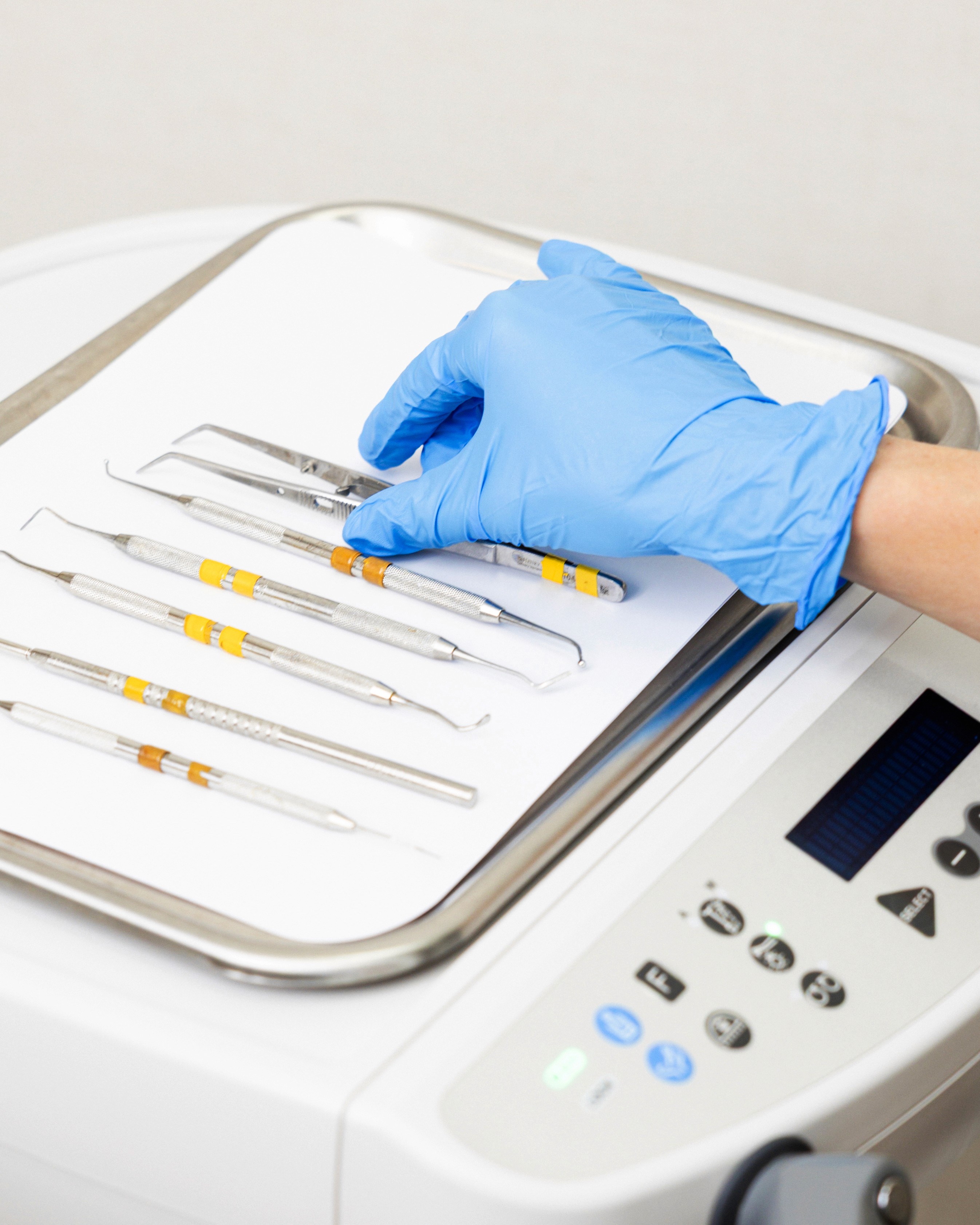 Tooth Fillings at ScarboroSmiles Dental Clinic in Scarborough, ON | Best dentist in Scarborough.
