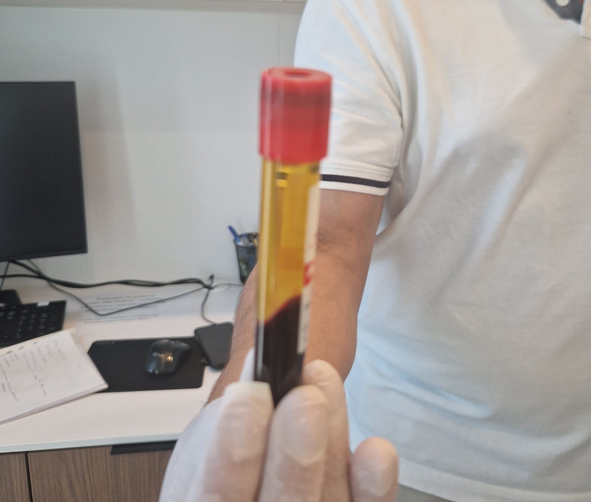 PRF terapia v stomatológii a čeľustnej chirurgii – prirodzená podpora hojenia z vlastnej krvi pacienta. ALFA DENT