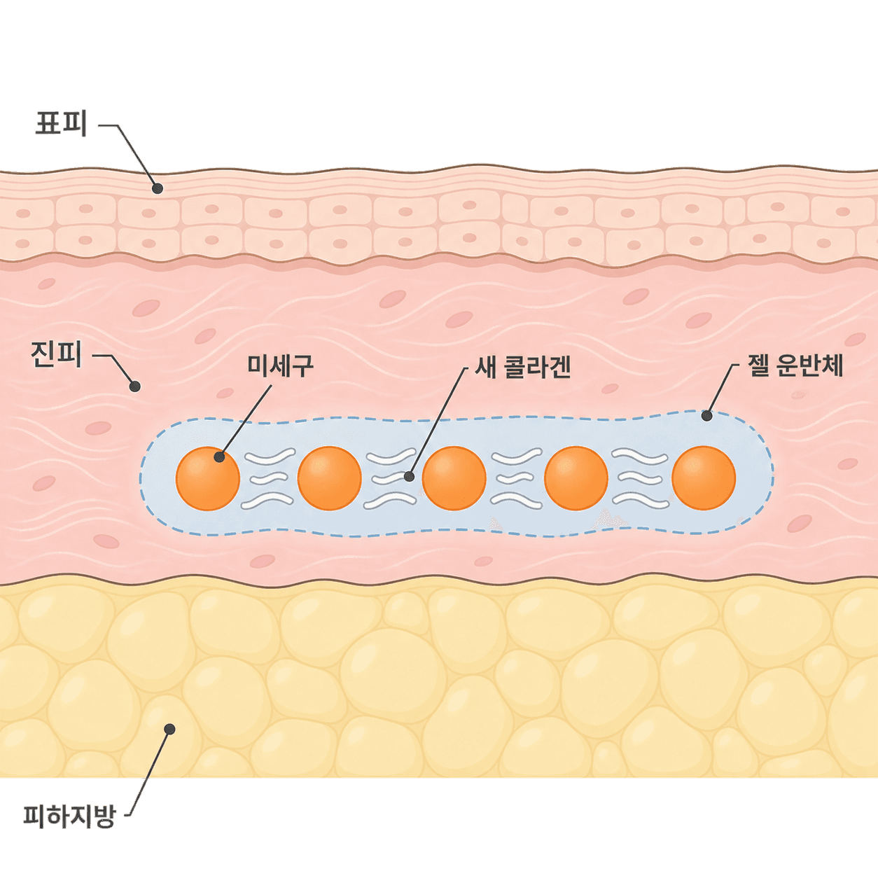 먼저 사라지는 자리와 나중까지 남는 자리가 달라요.