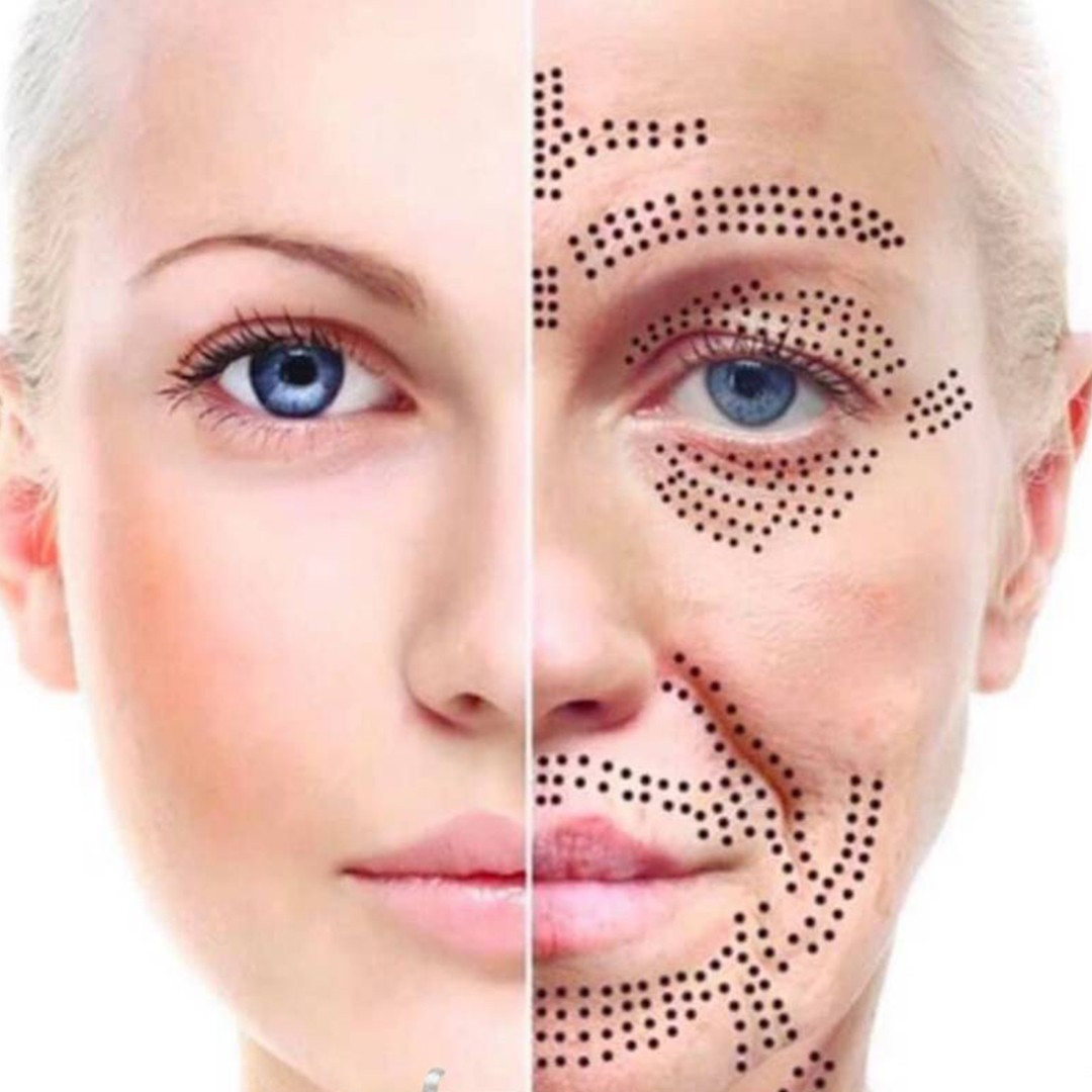 woman doing liposuction on her face