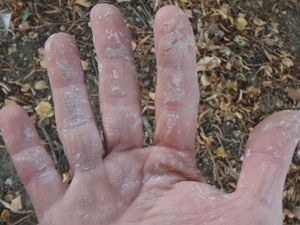 Méthode pour enlever la mousse polyuréthane expansive des mains en toute sécurité