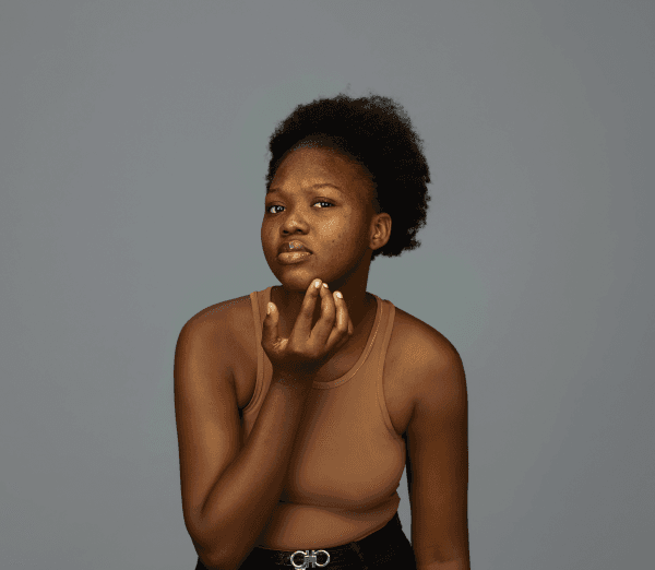 A Ghanaian woman worried about her skin