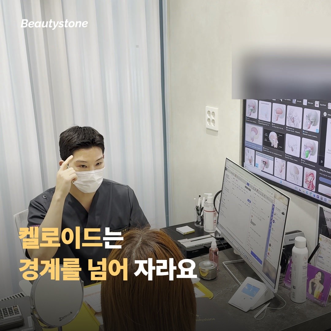 켈로이드는 경계를 넘어 자라요