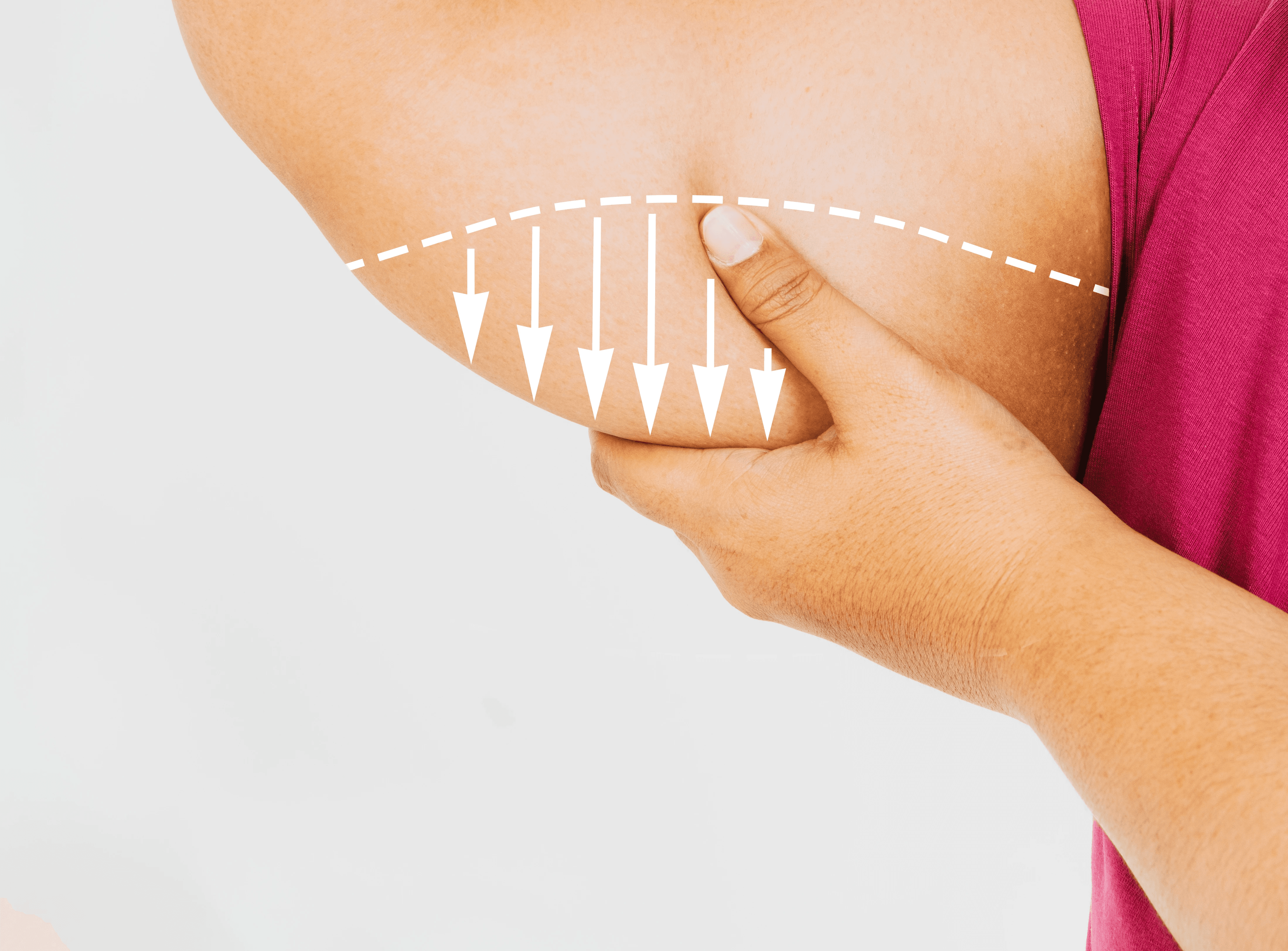 Weight loss in Cape Coral Near Me
