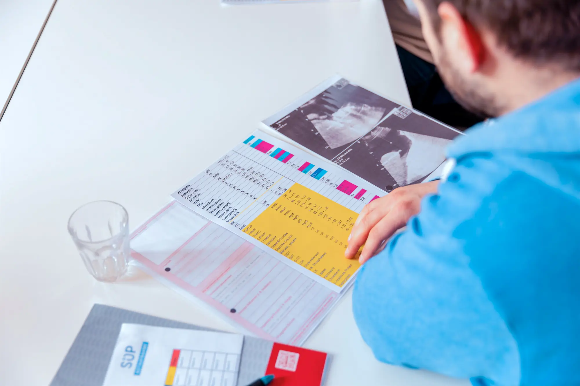 Ein Tablett mit verschiedenen rechteckigen Teilchen – manche mit Streuseln, andere glasiert – ordentlich auf einer weißen Oberfläche angeordnet.