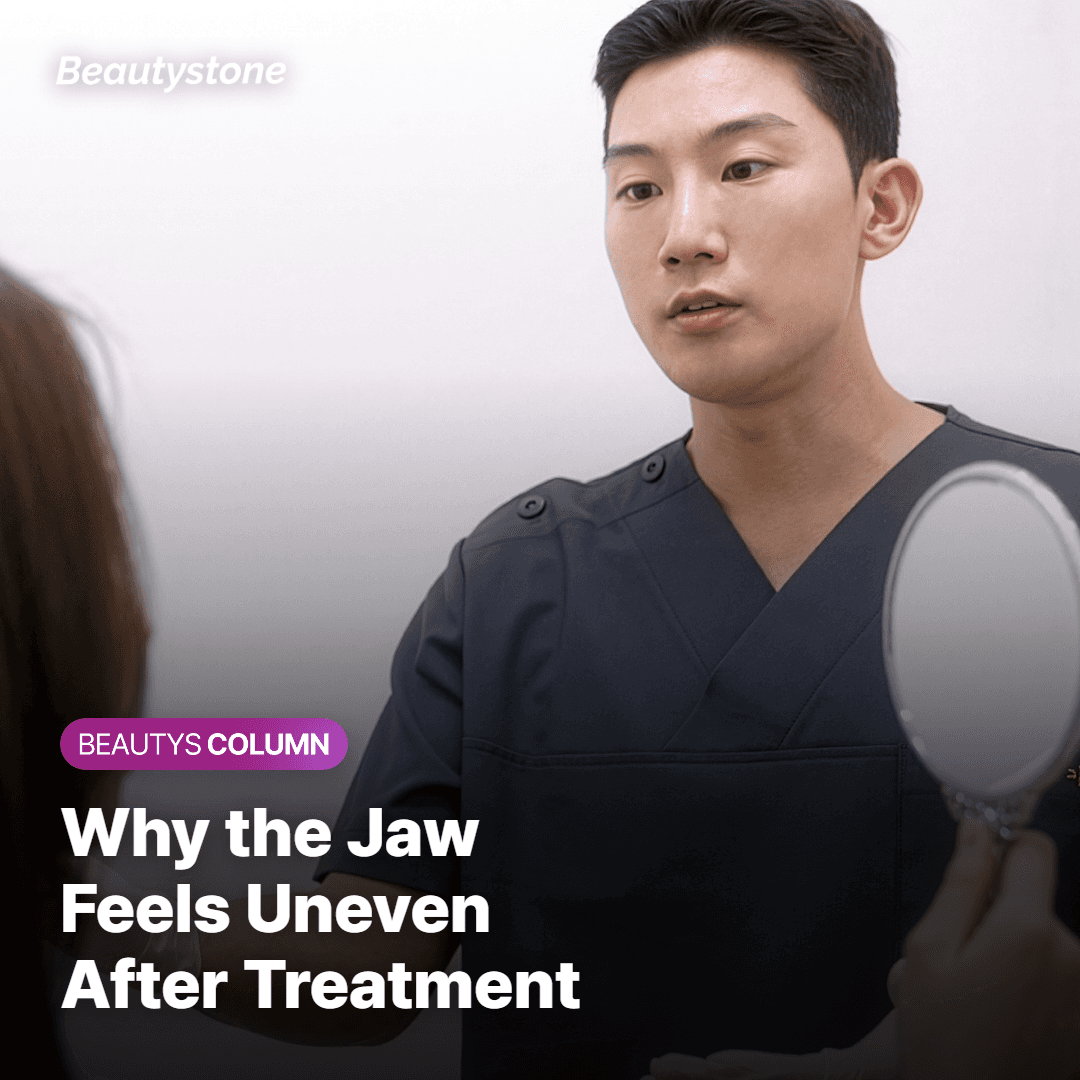 Illustration showing week-by-week recovery timeline after InMode FX jawline treatment with swelling reducing over four weeks