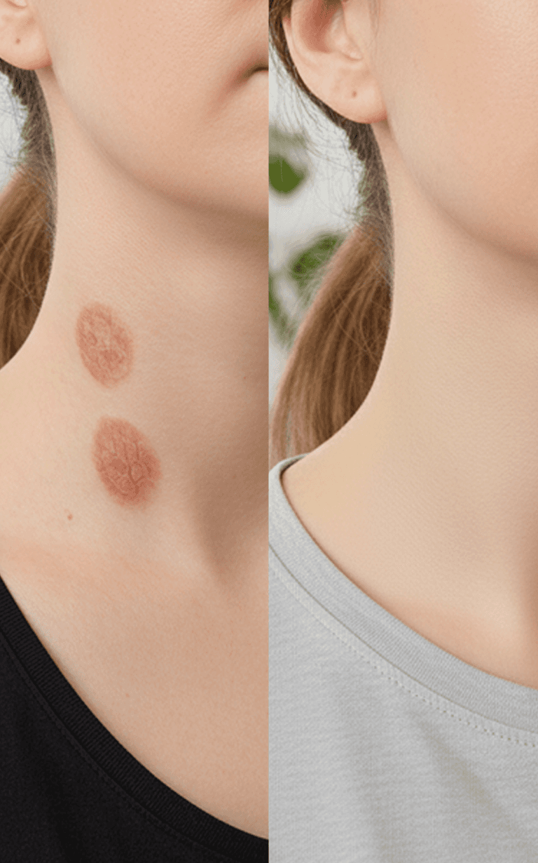 Before and after treatment - arm