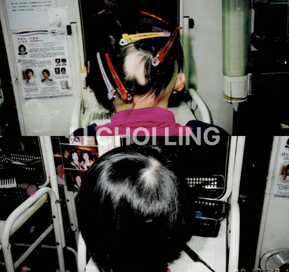 lichoiling casestudy