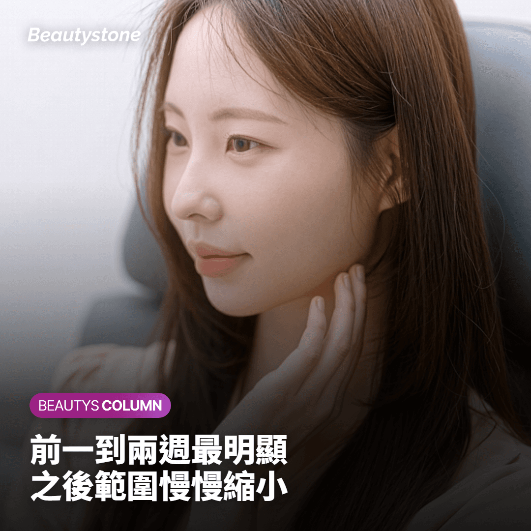 哪些狀況通常還在恢復的過程裡