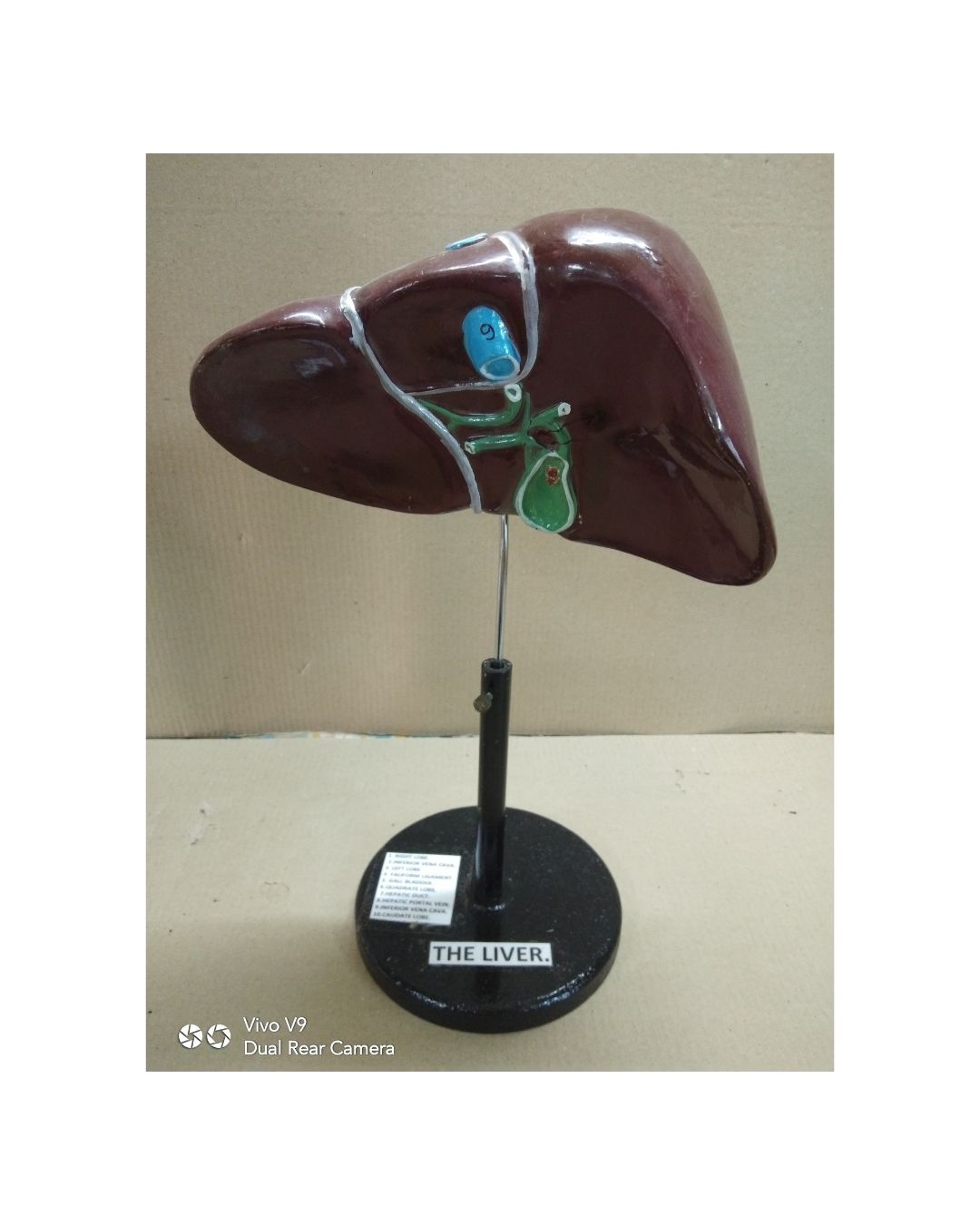 Liver Model