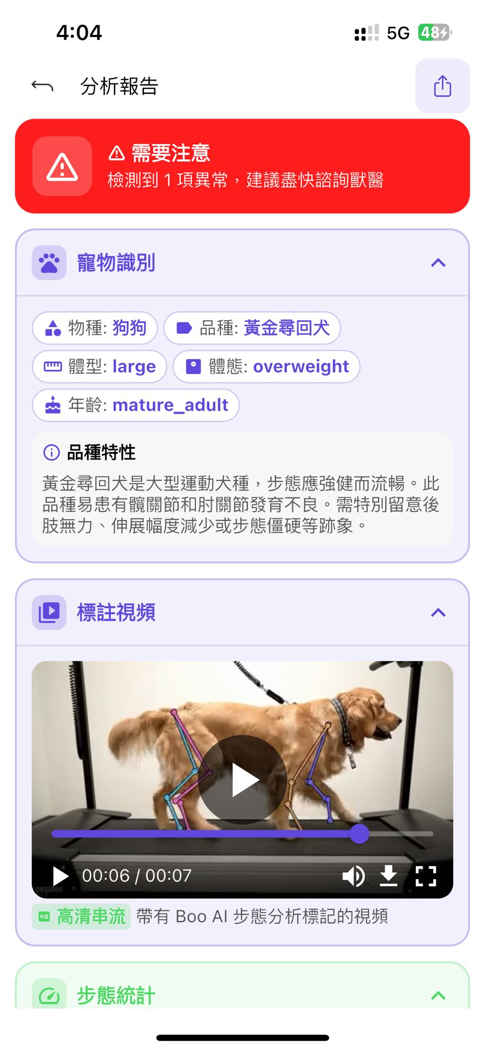 BOO AI Gait analysis