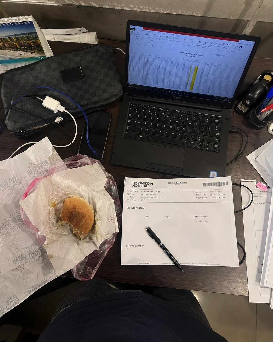 Irregular diet routine