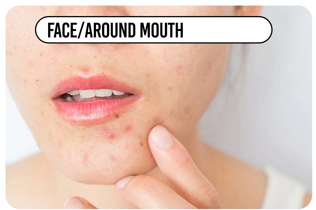 Face / around mouth