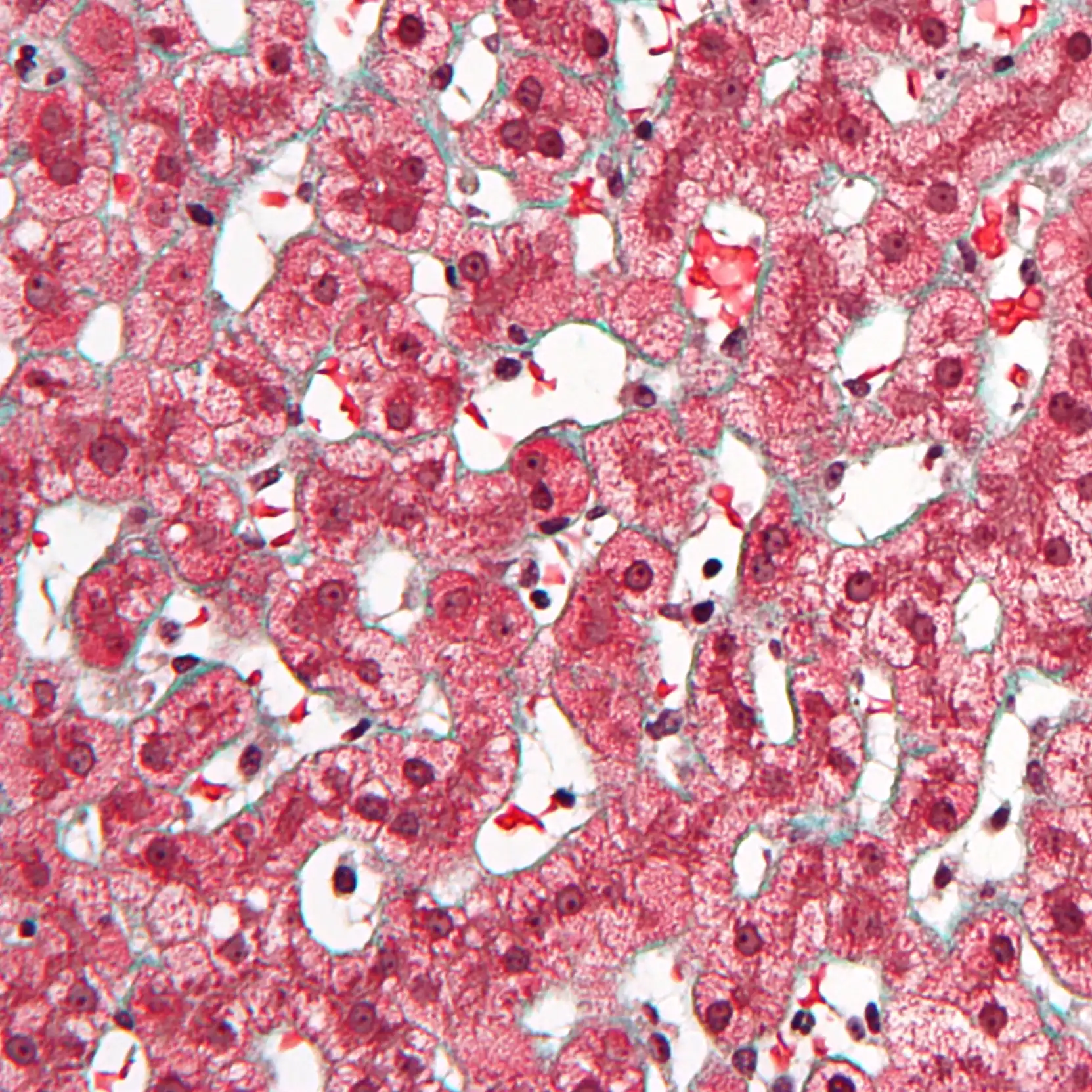 liver