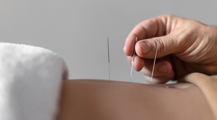 Acupuncture Clinic