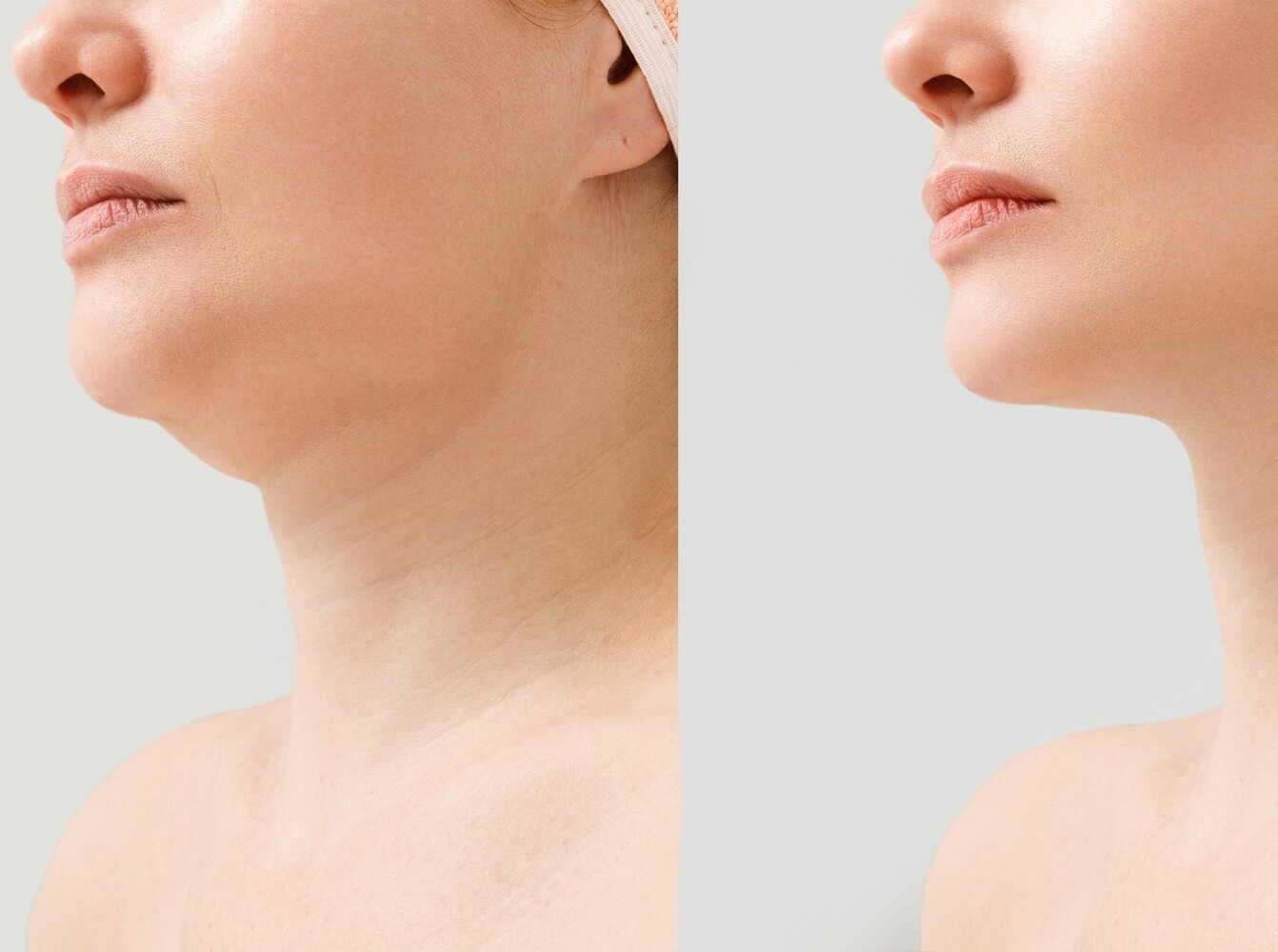 how to lose weight in your face