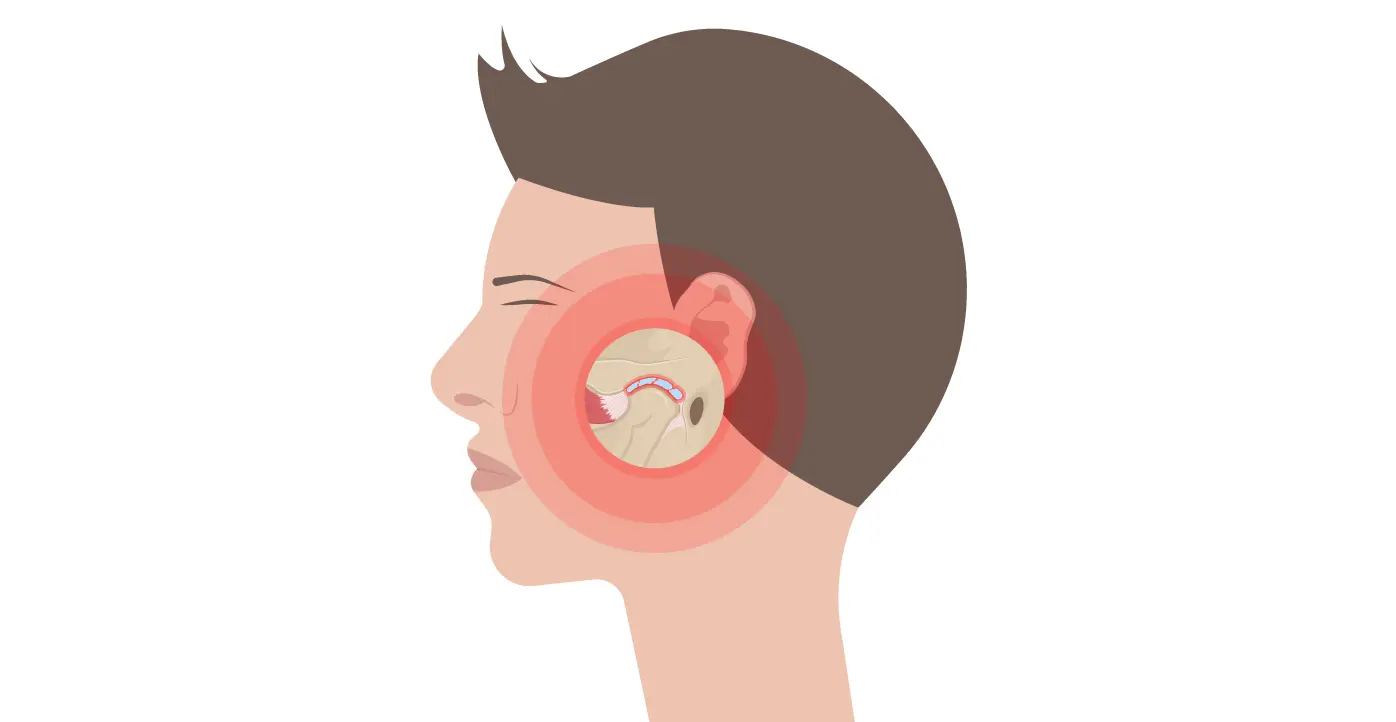Disfunção Temporomandibular: Saiba os sintomas e tratamento