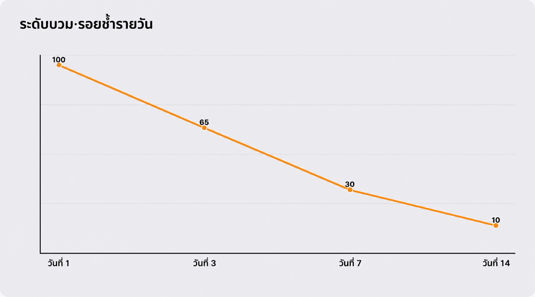 ระดับอาการบวมและช้ำตามวันฟื้นตัว